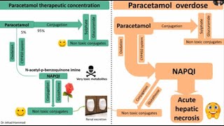 Paracetamol (Acetaminophen) hepatotoxicity and its management.