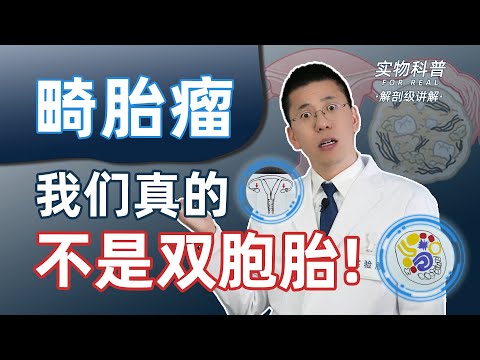 畸胎瘤：咱俩真的不是双胞胎！妇科医生解剖级科普“畸胎瘤”