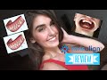 Invisalign Review Video - What They Don&#39;t Tell You: Dating, Kissing, and MORE