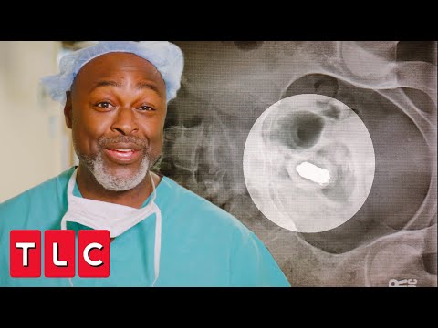 Patient Lost a Sex Toy in Her Rectum! | Stuck