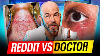 Dermatologist Reacts to 14 Real Skin Cases from Reddit