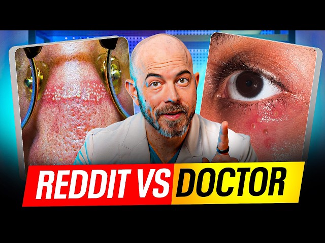 Dermatologist Reacts to 14 Real Skin Cases from Reddit