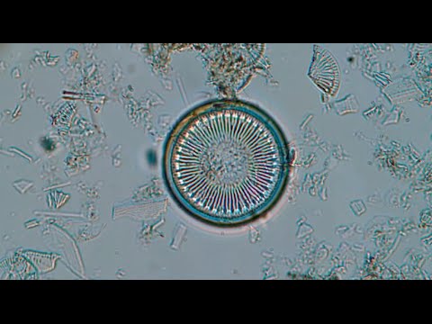 Diatom algae populations tell a story about climate change in Greenland - Science Nation