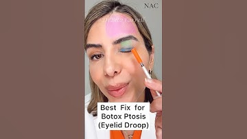 #ptosis #botox #eyelidptosis #droopyeyelids #heavyeyes #ptosisfix #botoxtraining #drbitafarrell