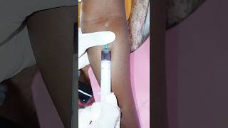 How To Take A Blood Sample