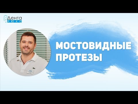 Показания, плюсы и минусы, виды и срок эксплуатации мостовидных протезов