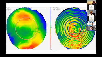 Presentation - The Lucidis EDOF IOL by Dr. Andrea Russo