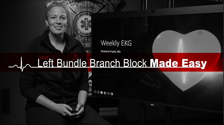 Left Bundle Branch Block Made Easy