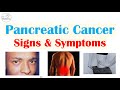 Pancreatic Cancer Signs &amp; Symptoms (&amp; Why They Occur)