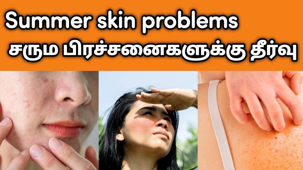 Skin Problem Solution Tips Skin problem solution சரும பிரச்சனைகளுக்கு எளிய 5 தீர்வு ! Doctors tips ...