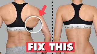 Dr Monga Clinic - Exercises to Get Rid of Back #Fat and #Bra