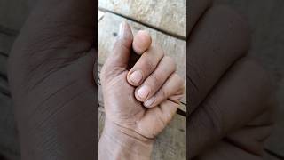 Something That Looks Like A Erfly