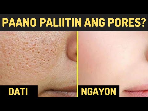 Video: Payo ng Dalubhasa sa Paano Ma-minimize ang Pores Naturally