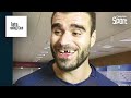 Le top 3 des dents perdues au rugby