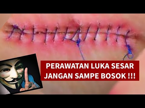 Mandi Setelah Operasi Caesar - Homecare24