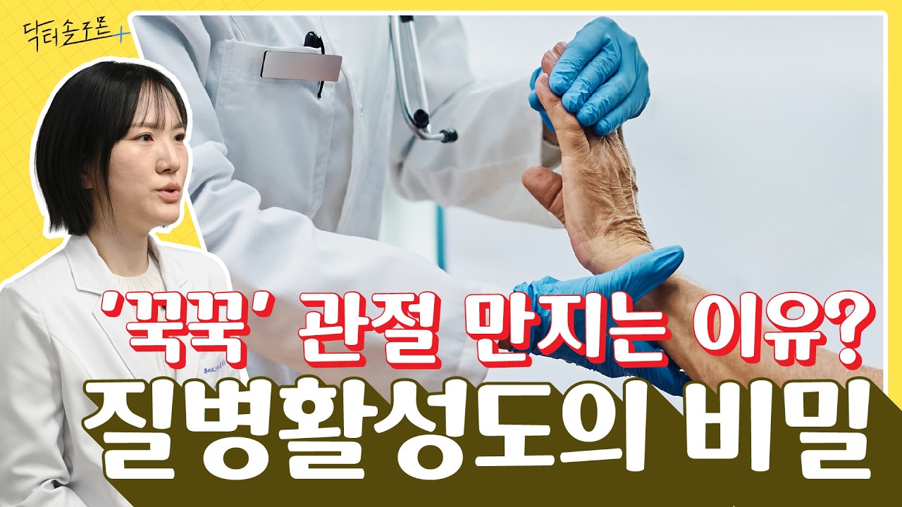 내 류마티스관절염은 얼마나 심각할까? 질병활성도(DAS28)의 비밀 | 닥터솔로몬