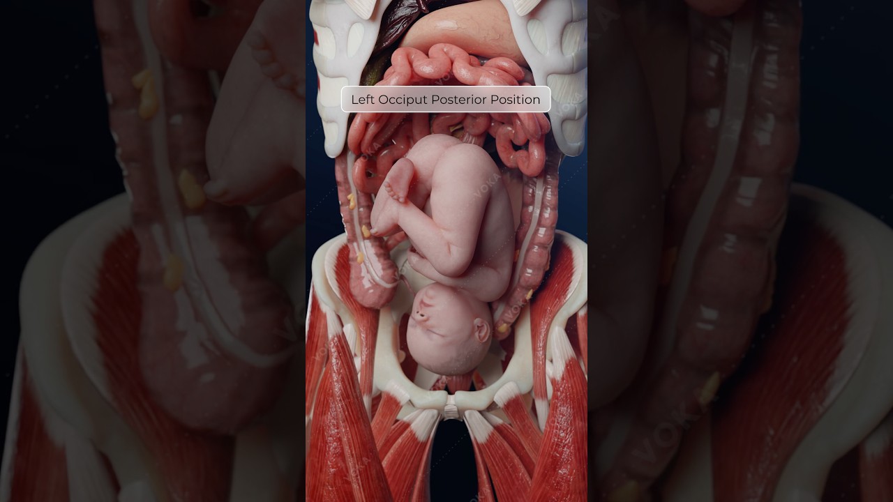 Fetal Position and Variety: Understanding Orientation in the Uterus in 3D