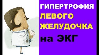 Гипертрофия левого желудочка на ЭКГ: рекомендации кардиолога Гипертрофия левого желудочка на ЭКГ: рекомендации кардиолога