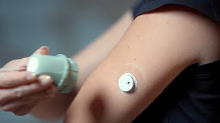 LinX CGM for Real-Time Blood Glucose Alerts: Maximum Privacy, Ultimate Monitoring