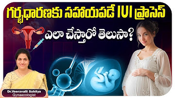 IUI Procedure Explained Clearly | Complete IUI Journey - What Happens at Every Step