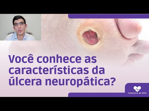 Vídeo: As úlceras neuropáticas são dolorosas?