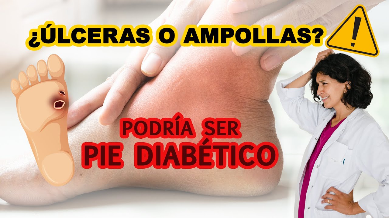 Remedios ampollas pies