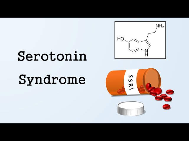 Serotonin Syndrome class=
