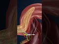 How Food Turns Into Waste Inside the Body (3D Animation) #medicalanimation #3danimation