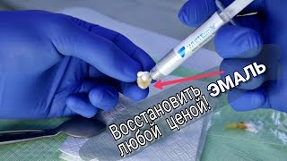 Восстановление Эмали. Битва Продолжается ч 2