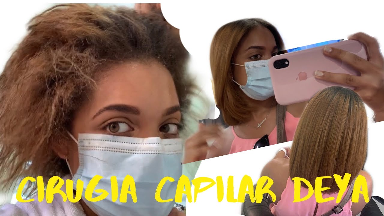 ME APLIQUE LA CIRUGÍA PLÁSTICA  CAPILAR DEYA!