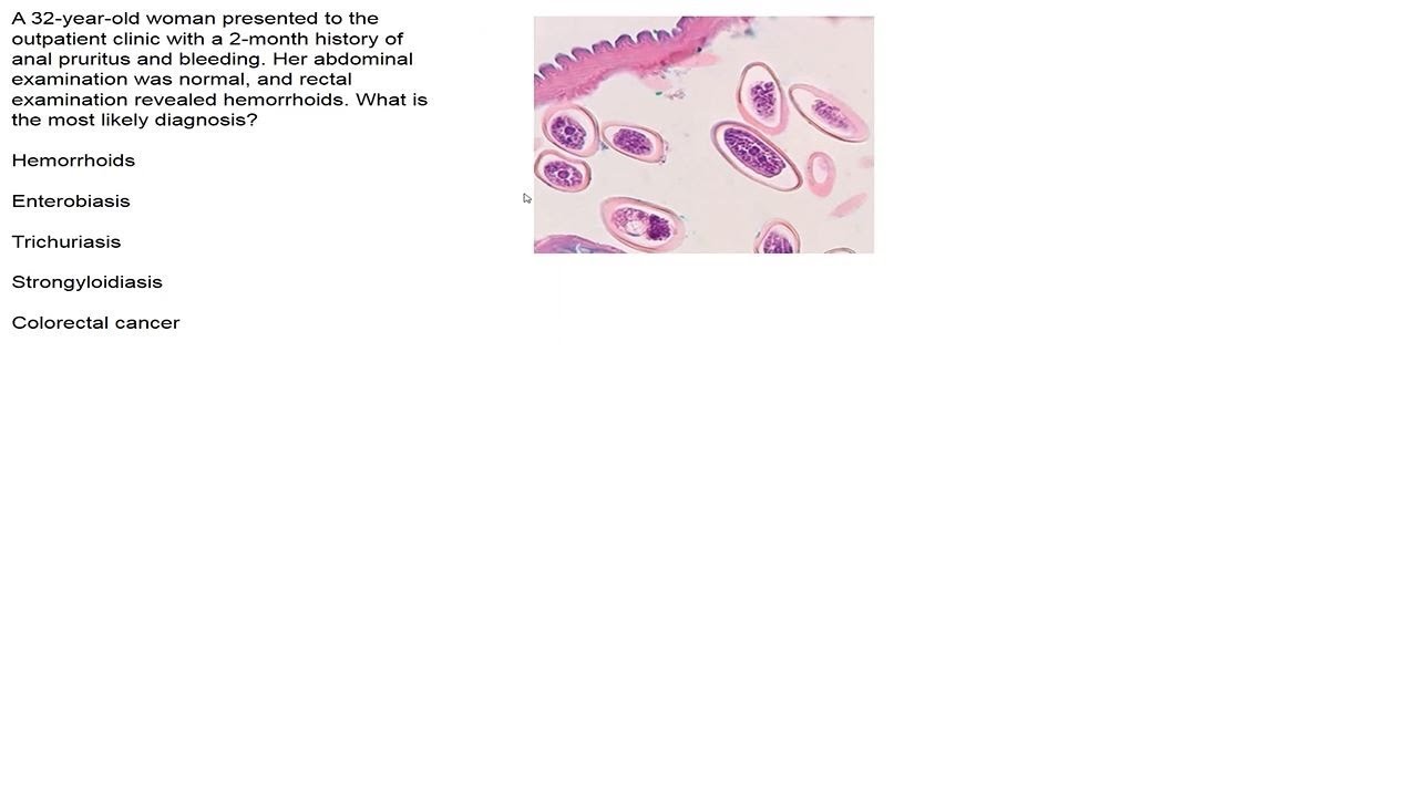 Charité Clinical Journal Club (German) by Fred Luft - 03.07.2019