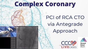 PCI of RCA CTO via Antegrade Approach - CCC Live Cases August 2017