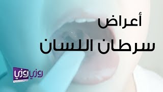 أعراض سرطان اللسان