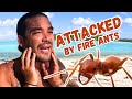 SEVERE ALLERGIC REACTION on a DESERTED ISLAND! -  (Episode 238)