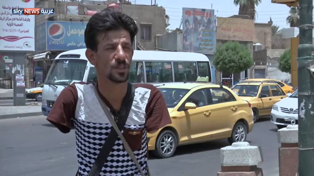 أيمن.. معاناة مبتور يأمل في سند