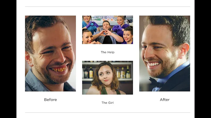 Can't Feel My Face Dental Parody - 'Numb with You' - The Weeknd