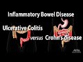 Ulcerative Colitis versus Crohn's Disease, Animation