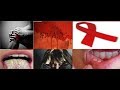 Hivaids dalili za ukimwi 10 za awalikapime vvu