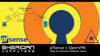 pfSense | OpenVPN | How to setup remote user access