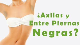 Los Mejores Remedios para Manchas en Axilas y Entrepiernas!