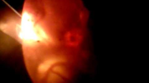 Candling python eggs at 36 days