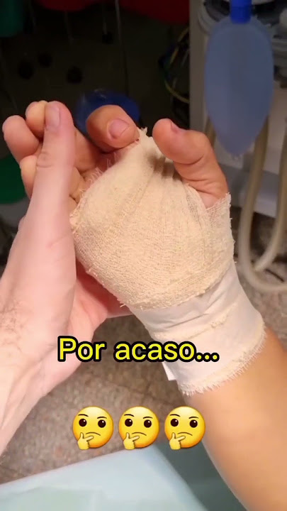 Quanto tempo para se recuperar de uma cirurgia de túnel do carpo?