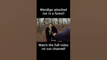 Watch The Full Video Up NOW Wendigo 