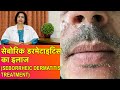 सेबोरिक डर्मेटाइटिस और डैंड्रफ का ईलाज || Dandruff & Seborrheic Dermatitis Treatment