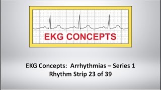 EKG Concepts: Arrhythmias Course - Strip 23 of 39