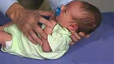physical exam -Newborn Normal: Primitive Reflexes - Moro