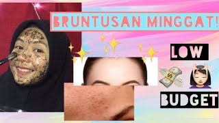 Diy Masker Alami Menghilangkan Bruntusan Dengan Cepat Berlian Sari