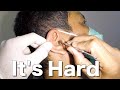 Man&#39;s HARD Earwax Removed &amp; Scooped Out Using An Ear Curette