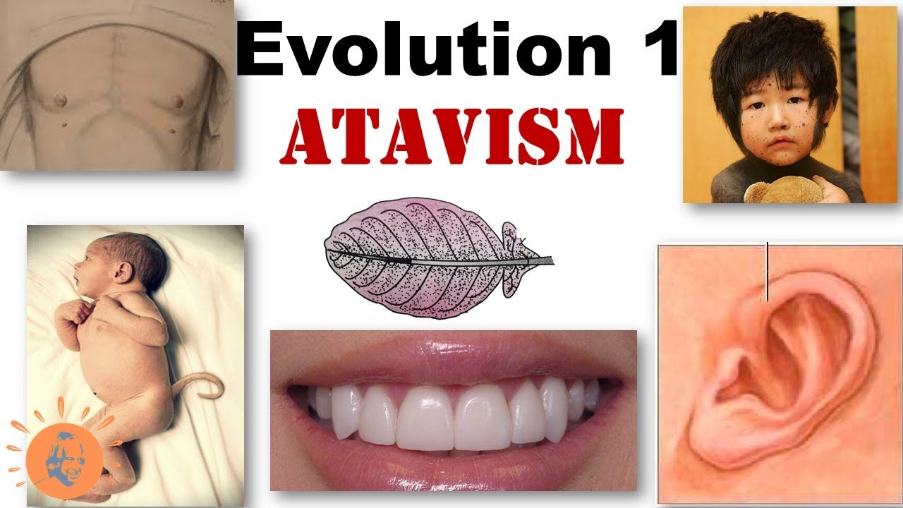 Atavism Reversion Evidences of Evolution Tail in Human Baby Dr