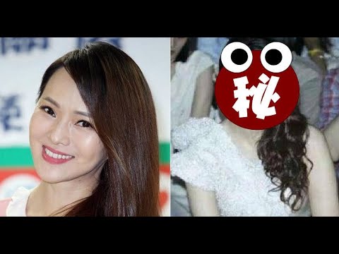 伊能靜「近照曝光」，臉上塗滿 3層粉，居然擋不住整容失敗 留下的玻尿酸阿！